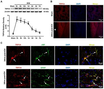 TRPV4 Blockade Preserves the Blood–Brain Barrier by Inhibiting Stress Fiber Formation in a Rat Model of Intracerebral Hemorrhage